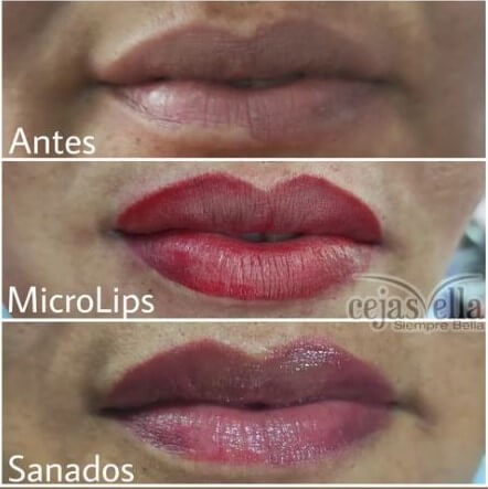 Micropigmentación de labios de apariencia natural